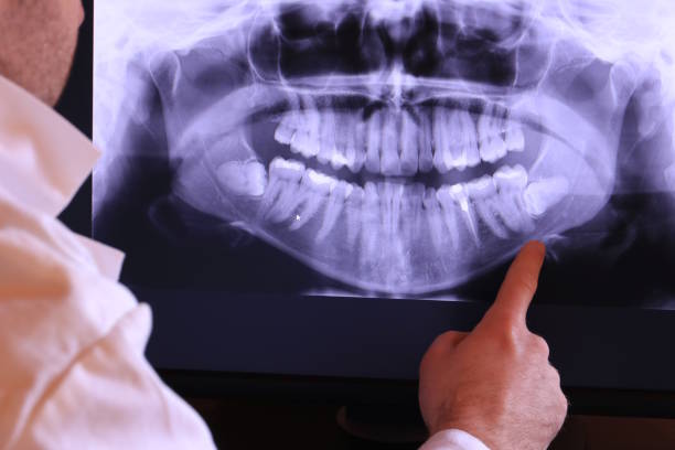 Best Emergency Dentist for Knocked-Out Tooth in Calais, ME