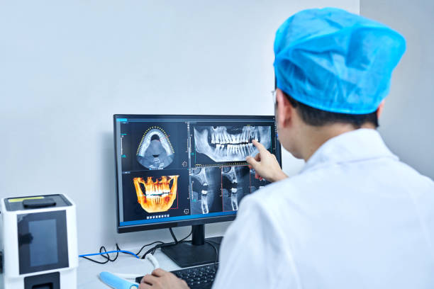 Best Emergency Dentist for Lost Fillings or Crowns in Calais, ME